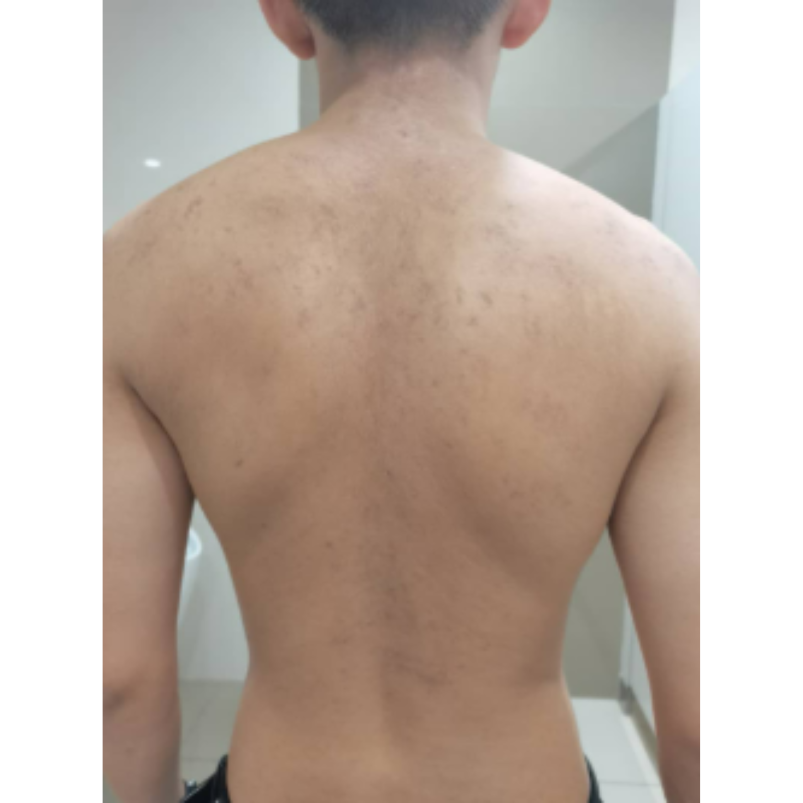 After image